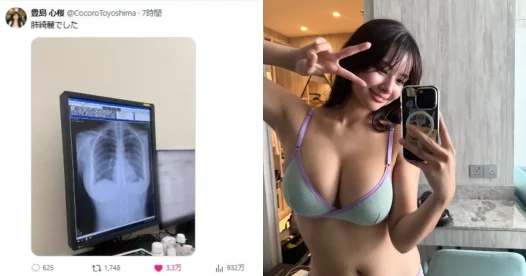 写真偶像丰岛心樱上传胸部X光照 浮现的胸部线条让网友直喊：没想过连X光都这么色…