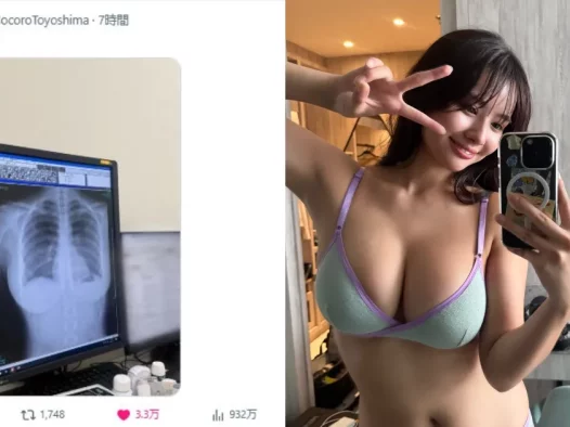 写真偶像丰岛心樱上传胸部X光照 浮现的胸部线条让网友直喊:没想过连X光都这么色…